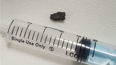 السبب قطعة أسمنت.. إنقاذ حياة طفل بعملية في  القصبة الهوائية بمستشفى كفر الشيخ العام