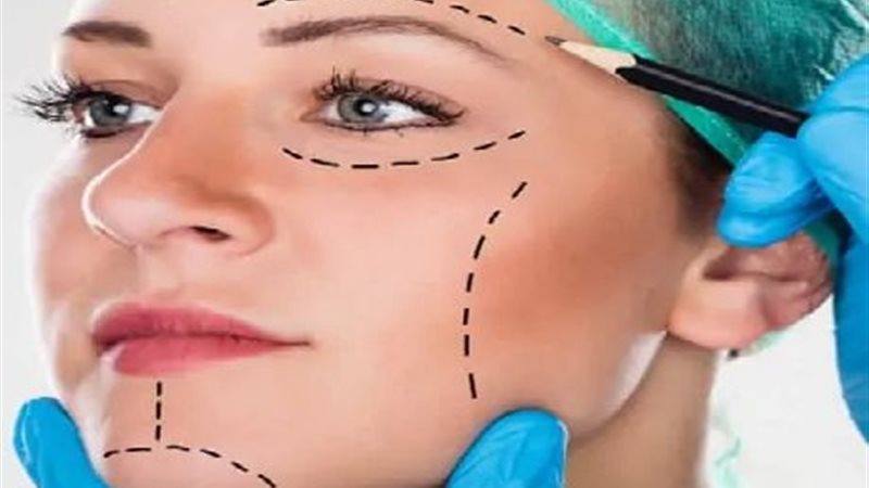 عملية تجميل الأنف