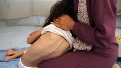 فيروس مجهول يضرب غزة.. ووزير إسرائيلي: «من لا يموت بالرصاص سيموت جوعا»