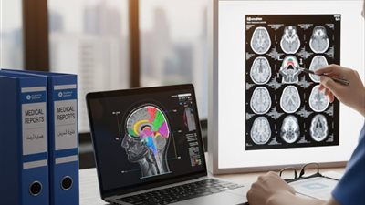 ترجمة تقرير أشعة رنين مغناطيسي للمخ