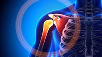  اسباب فرقعة مفصل الكتف وكيف يؤثر على المفصل؟