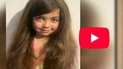 والدة الطفلة أيسل ضحية الاعتداء بحمام السباحة: الحادث سبب لبنتي سكتة قلبية