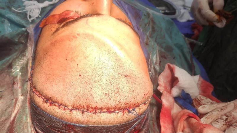 احد العمليات 