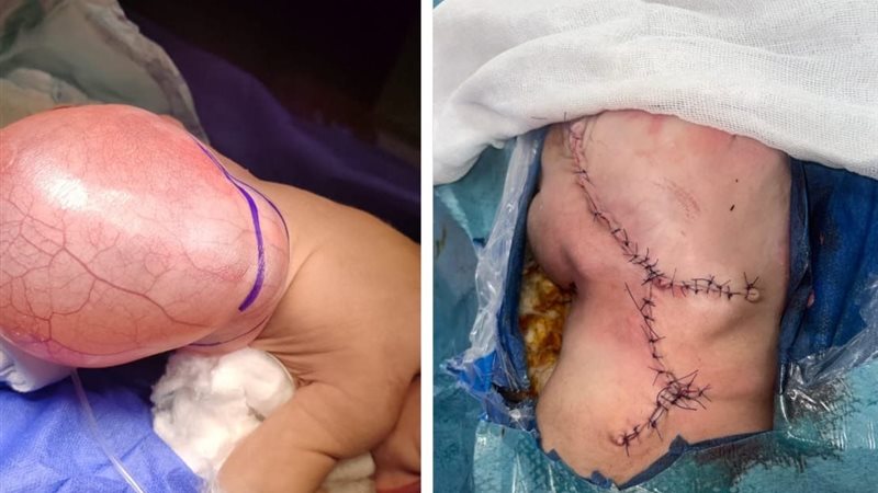 العملية الجراحية