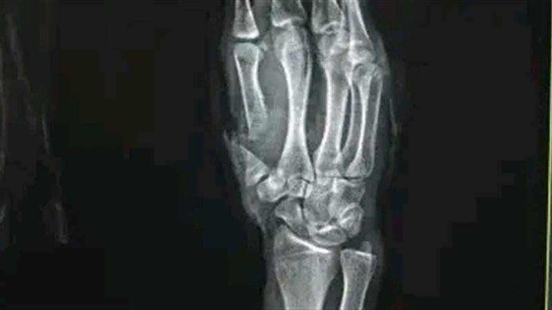 جانب من العملية