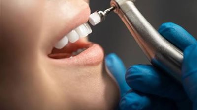 صحة الأسنان.. مؤشر مهم لطول العمر والصحة العامة