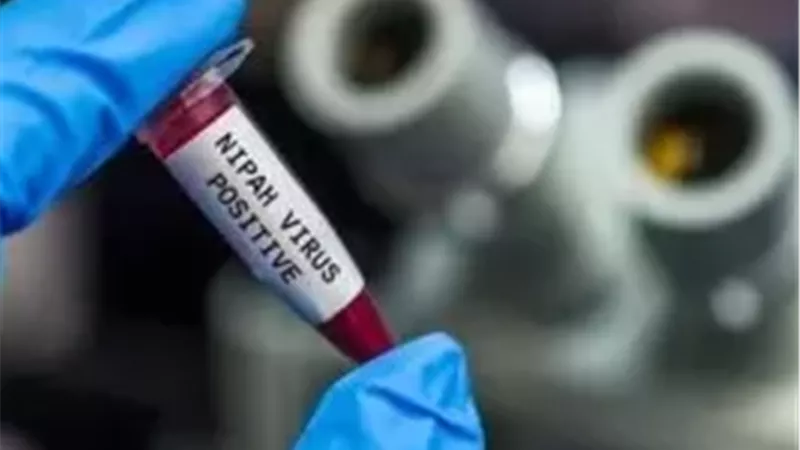 فيروس نيباه