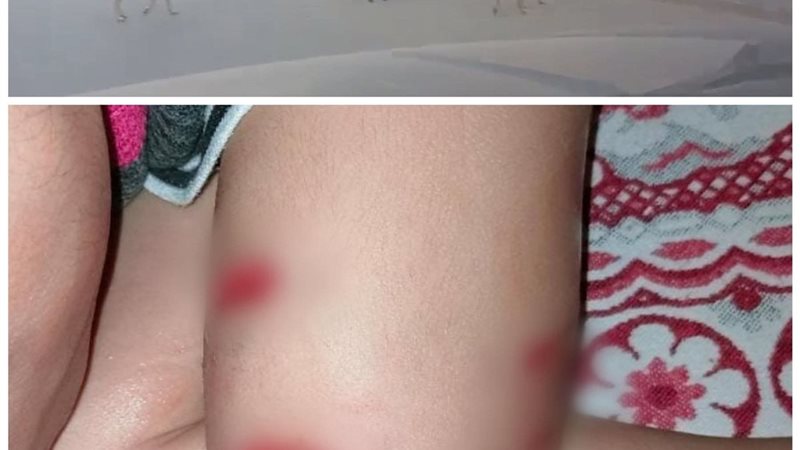 كلب مسعور يعقر طفل