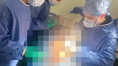 مستشفي بنها الجامعي تعلن إنقاذ حياة مريضة تعاني من ضيق شديد وحرج بالشرايين التاجية 