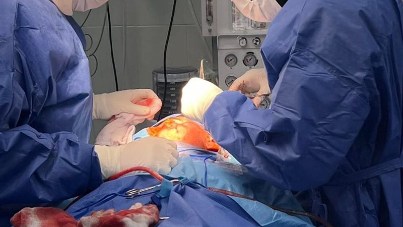 نجاح جراحة دقيقة